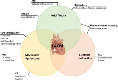 Left Atrial Cardiomyopathy – A Challenging Diagnosis